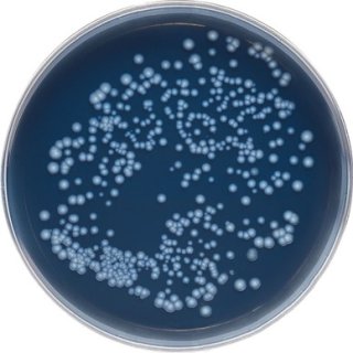 Round microbe growth plate with blue agar and large amount of Legionella growth 