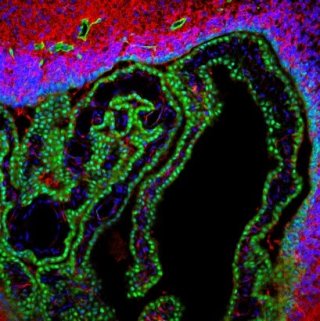 Image of the brain barriers in the developing rat, which are affected by thyroid disruption. Image courtesy of lab member Aubrey Sasser (ORISE). 